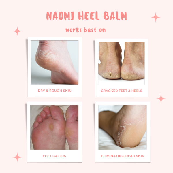 (1+1) Naomi 539 Heel Balm Massage Cream - Image 4